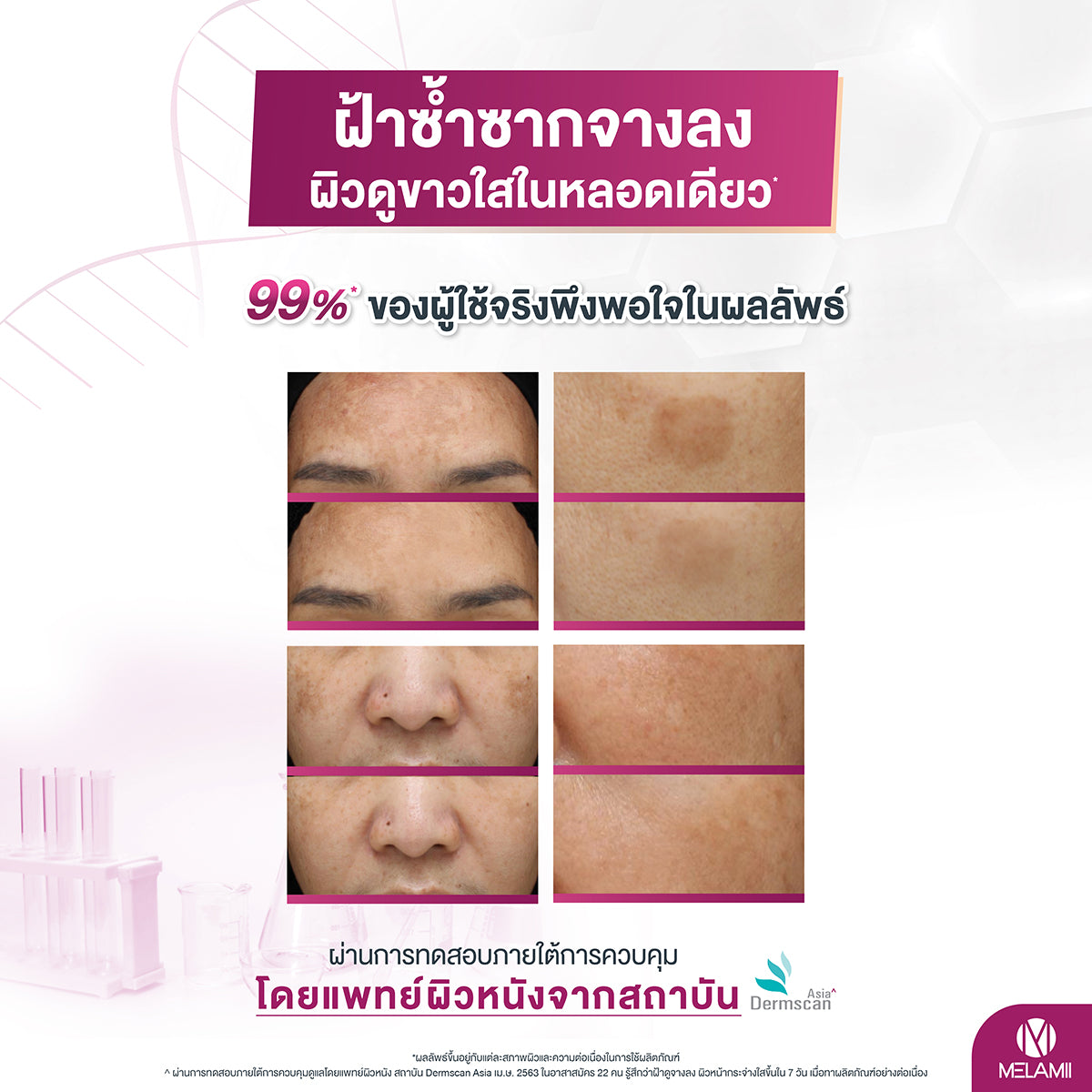 MELAMII Anti Melasma  15g.