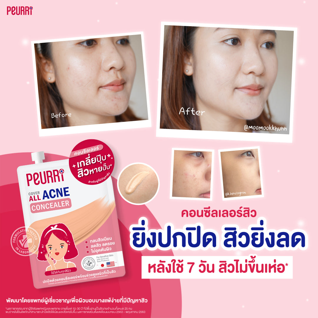 PEURRI Cover All Acne Concealer 3g.X6