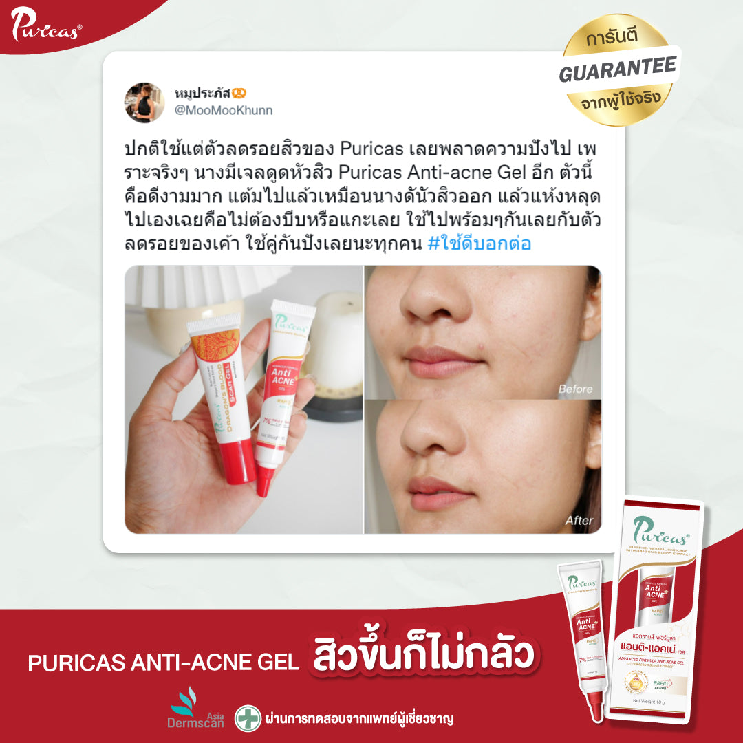 Duo set PURICAS Scar Gel 20g +Anti-Acne Gel 10g.