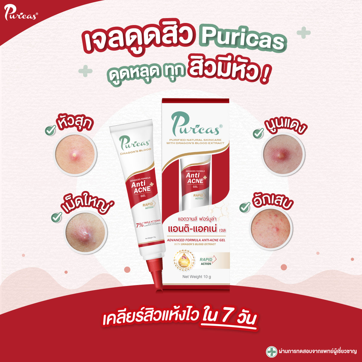 PURICAS  Anti-acne Gel 10g.