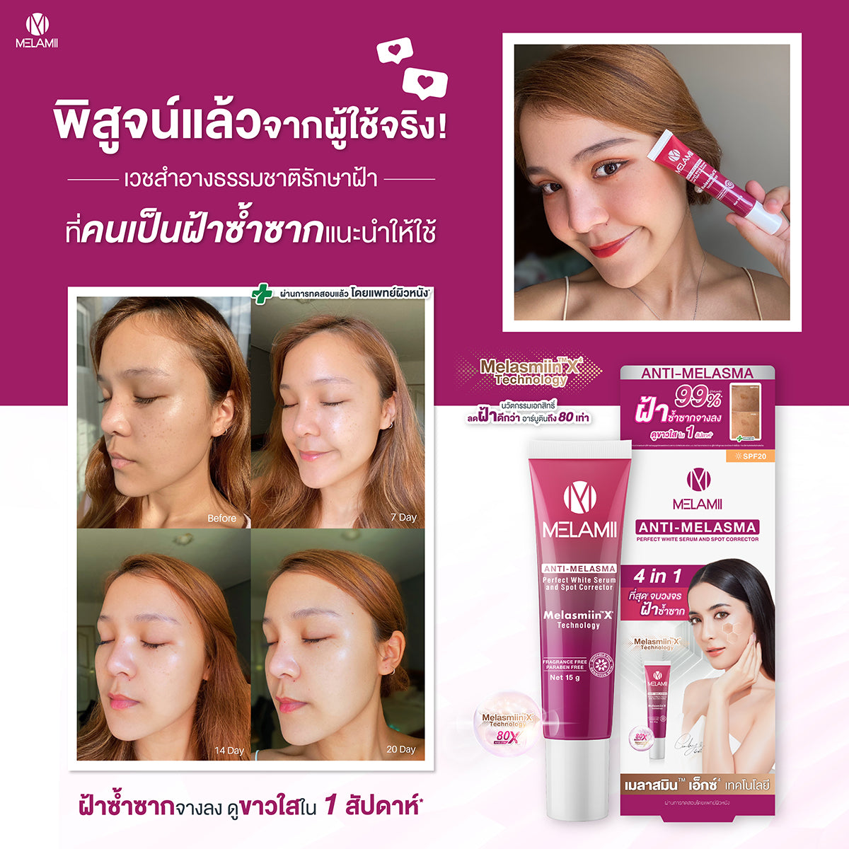 MELAMII Anti Melasma  15g. +  Melasma  8g.